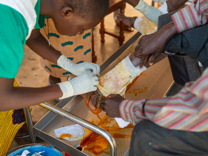 PASPANGA • Il Lebbrosario di Ougadougou